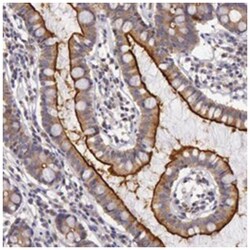 PCTK1 Rabbit anti-Human, Mouse, Rat, Polyclonal Antibody, Abnova 100&mu;L;
