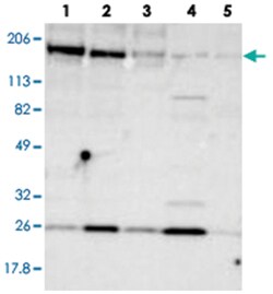 ERBB2 Rabbit anti-Human, Polyclonal Antibody, Abnova 100&mu;L; Unlabeled:Antibodies,