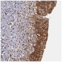 ERBB2 Rabbit anti-Human, Polyclonal Antibody, Abnova 100&mu;L; Unlabeled:Antibodies,