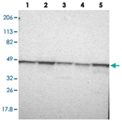 FLOT1, Rabbit, Polyclonal Antibody, Abnova 100 &mu;L | Buy Online | Abnova Corporation | Fisher Scientific