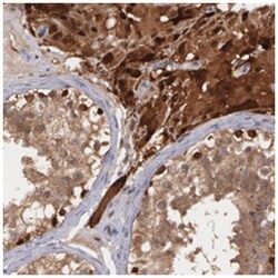 TXNRD1 Rabbit anti-Human, Polyclonal Antibody, Abnova 100&mu;L; Unlabeled:Antibodies,