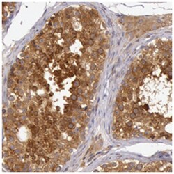 CHUK Rabbit anti-Human, Polyclonal Antibody, Abnova 100&mu;L; Unlabeled:Antibodies,