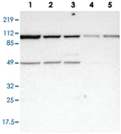 ASCC2, Rabbit, Polyclonal Antibody, Abnova 100&mu;L; Unlabeled:Antibodies,