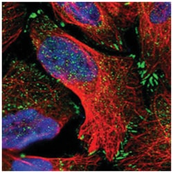 ASCC2, Rabbit, Polyclonal Antibody, Abnova 100&mu;L; Unlabeled:Antibodies,
