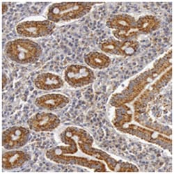 C7, Rabbit, Polyclonal Antibody, Abnova 100&mu;L; Unlabeled:Antibodies,