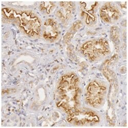 STX7, Rabbit, Polyclonal Antibody, Abnova 100 &mu;L | Buy Online | Abnova Corporation | Fisher Scientific