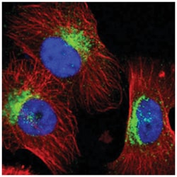 STX7, Rabbit, Polyclonal Antibody, Abnova 100 &mu;L | Buy Online | Abnova Corporation | Fisher Scientific