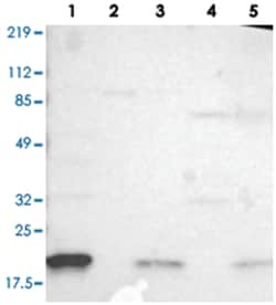IL1RN, Rabbit, Polyclonal Antibody, Abnova 100 &mu;L | Buy Online | Abnova Corporation | Fisher Scientific