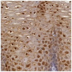 IL1RN, Rabbit, Polyclonal Antibody, Abnova 100 &mu;L | Buy Online | Abnova Corporation | Fisher Scientific