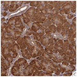 ECE1, Rabbit, Polyclonal Antibody, Abnova 100&mu;L; Unlabeled:Antibodies,