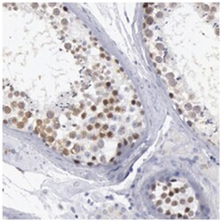 SMC1B, Rabbit, Polyclonal Antibody, Abnova 100&mu;L; Unlabeled:Antibodies,