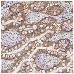 LBP Rabbit anti-Human, Polyclonal Antibody, Abnova 100&mu;L; Unlabeled:Antibodies,