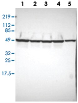 ATP5B Rabbit anti-Human, Mouse, Rat, Polyclonal Antibody, Abnova 100&mu;L;