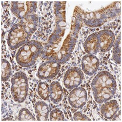 ATP5B Rabbit anti-Human, Mouse, Rat, Polyclonal Antibody, Abnova 100&mu;L;