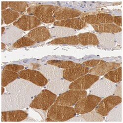 BCHE, Rabbit, Polyclonal Antibody, Abnova 100&mu;L; Unlabeled:Antibodies,