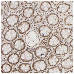 RBM39 Rabbit anti-Human, Polyclonal Antibody, Abnova 100&mu;L; Unlabeled:Antibodies,
