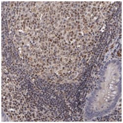 ELK3 Rabbit anti-Human, Polyclonal Antibody, Abnova 100 &mu;L | Buy Online | Abnova Corporation | Fisher Scientific