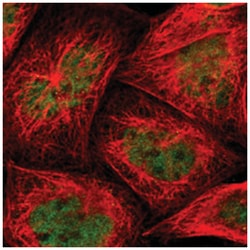ELK3 Rabbit anti-Human, Polyclonal Antibody, Abnova 100 &mu;L | Buy Online | Abnova Corporation | Fisher Scientific