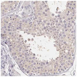 KIAA1333, Rabbit, Polyclonal Antibody, Abnova 100&mu;L; Unlabeled:Antibodies,