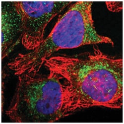 KRT18 Rabbit anti-Human, Polyclonal Antibody, Abnova 100&mu;L; Unlabeled:Antibodies,