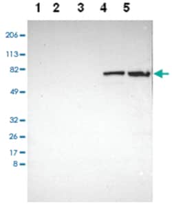 KNG1 Rabbit anti-Human, Polyclonal Antibody, Abnova 100 &mu;L | Buy Online | Abnova Corporation | Fisher Scientific