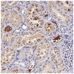 KNG1 Rabbit anti-Human, Polyclonal Antibody, Abnova 100 &mu;L | Buy Online | Abnova Corporation | Fisher Scientific