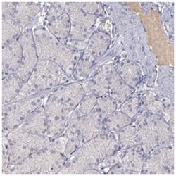 MASP1, Rabbit, Polyclonal Antibody, Abnova 100&mu;L; Unlabeled:Antibodies,