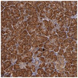 RIOK3, Rabbit, Polyclonal Antibody, Abnova 100&mu;L; Unlabeled:Antibodies,