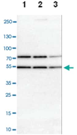 RBM22, Rabbit, Polyclonal Antibody, Abnova 100&mu;L; Unlabeled:Antibodies,