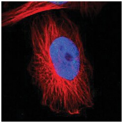 RBM22, Rabbit, Polyclonal Antibody, Abnova 100&mu;L; Unlabeled:Antibodies,