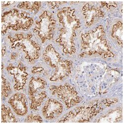 KNG1 Rabbit anti-Human, Polyclonal Antibody, Abnova 100 &mu;L | Buy Online | Abnova Corporation | Fisher Scientific