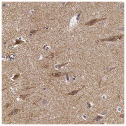 NLGN4X, Rabbit, Polyclonal Antibody, Abnova 100&mu;L; Unlabeled:Antibodies,