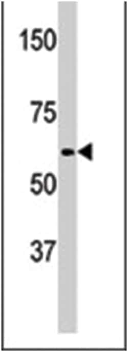 APPBP2, Rabbit, Polyclonal Antibody, Abnova 400 &mu;L | Buy Online | Abnova Corporation | Fisher Scientific