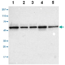 TOM1, Rabbit, Polyclonal Antibody, Abnova 100&mu;L; Unlabeled:Antibodies,