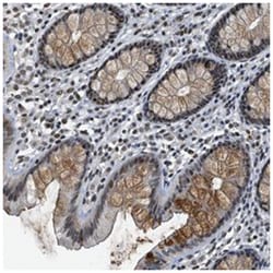 MZF1, Rabbit, Polyclonal Antibody, Abnova 100 &mu;L | Buy Online | Abnova Corporation | Fisher Scientific