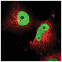 SOX9 Rabbit anti-Human, Mouse, Rat, Polyclonal Antibody, Abnova 100 &mu;L | Buy Online | Abnova Corporation | Fisher Scientific