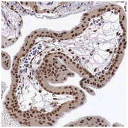 ARNT, Rabbit, Polyclonal Antibody, Abnova 100&mu;L; Unlabeled:Antibodies,