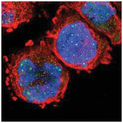 ARNT, Rabbit, Polyclonal Antibody, Abnova 100&mu;L; Unlabeled:Antibodies,