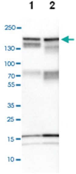 TJP2, Rabbit, Polyclonal Antibody, Abnova 100&mu;L; Unlabeled:Antibodies,