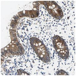 TJP2, Rabbit, Polyclonal Antibody, Abnova 100&mu;L; Unlabeled:Antibodies,