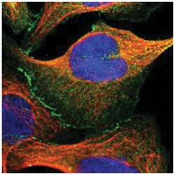 TJP2, Rabbit, Polyclonal Antibody, Abnova 100&mu;L; Unlabeled:Antibodies,