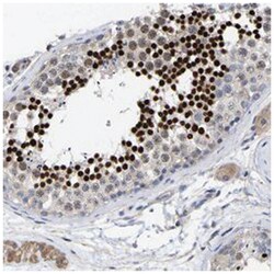 CREM, Rabbit, Polyclonal Antibody, Abnova 100&mu;L; Unlabeled:Antibodies,