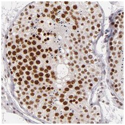 BRD8 Rabbit anti-Human, Polyclonal Antibody, Abnova 100 &mu;L | Buy Online | Abnova Corporation | Fisher Scientific