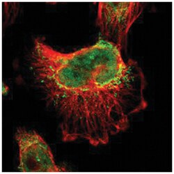 BRD8 Rabbit anti-Human, Polyclonal Antibody, Abnova 100 &mu;L | Buy Online | Abnova Corporation | Fisher Scientific