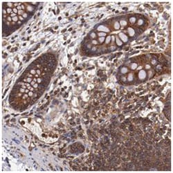 TMOD3, Rabbit, Polyclonal Antibody, Abnova 100 &mu;L | Buy Online | Abnova Corporation | Fisher Scientific
