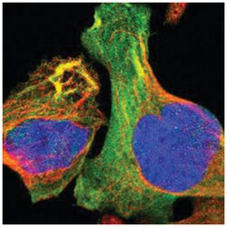 TMOD3, Rabbit, Polyclonal Antibody, Abnova 100 &mu;L | Buy Online | Abnova Corporation | Fisher Scientific