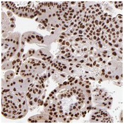 SP1 Rabbit anti-Human, Polyclonal Antibody, Abnova 100&mu;L; Unlabeled:Antikörper