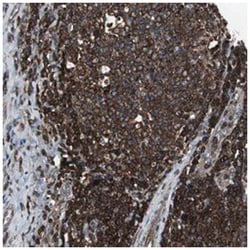 VAV1 Rabbit anti-Human, Polyclonal Antibody, Abnova 100 &mu;L | Buy Online | Abnova Corporation | Fisher Scientific