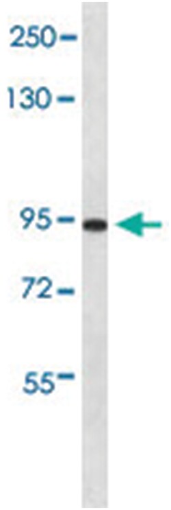 RGS9, Rabbit, Polyclonal Antibody, Abnova 400 &mu;L | Buy Online | Abnova Corporation | Fisher Scientific