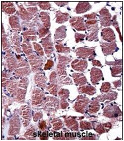 RGS9, Rabbit, Polyclonal Antibody, Abnova 400 &mu;L | Buy Online | Abnova Corporation | Fisher Scientific